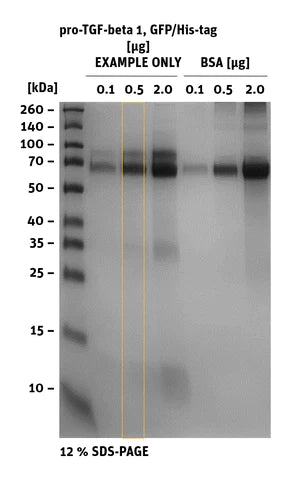 Protein:	pro-TGF-beta 1, His-tag
